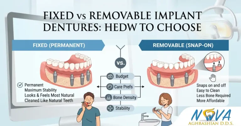 Fixed vs Removable Implant Dentures