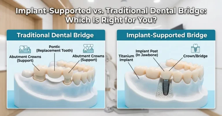 Implant-Supported vs. Traditional Dental Bridge: Which Is Right for You?
